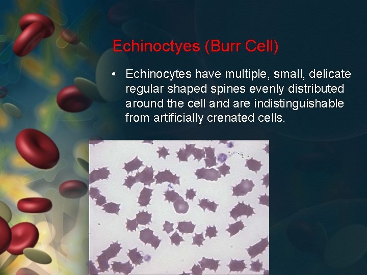 Echinoctyes (Burr Cell) • Echinocytes have multiple, small, delicate regular shaped spines evenly distributed