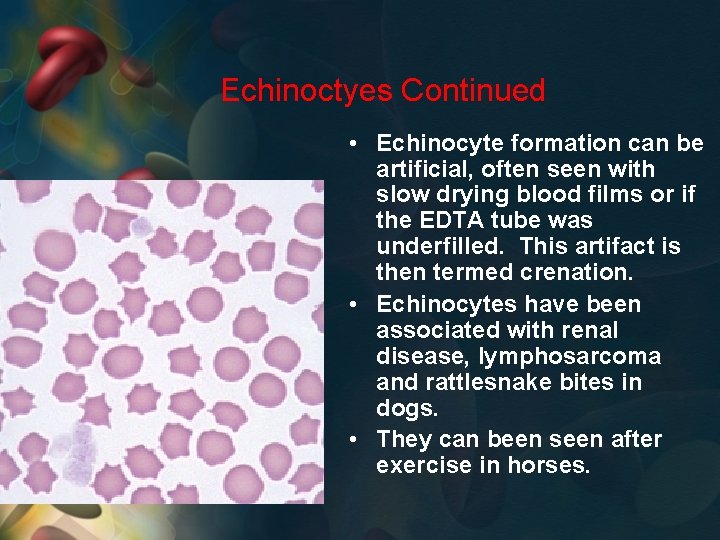 Echinoctyes Continued • Echinocyte formation can be artificial, often seen with slow drying blood