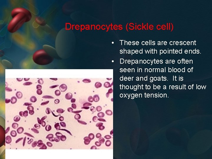 Drepanocytes (Sickle cell) • These cells are crescent shaped with pointed ends. • Drepanocytes