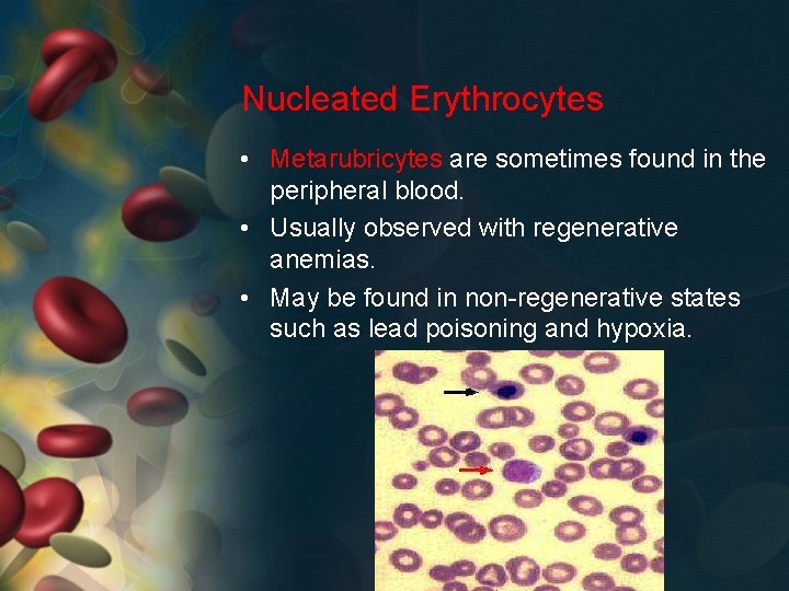Nucleated Erythrocytes • Metarubricytes are sometimes found in the peripheral blood. • Usually observed