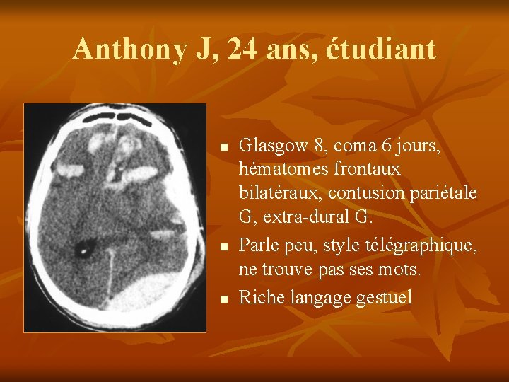 Anthony J, 24 ans, étudiant n n n Glasgow 8, coma 6 jours, hématomes Anthony J, 24 ans, étudiant n n n Glasgow 8, coma 6 jours, hématomes