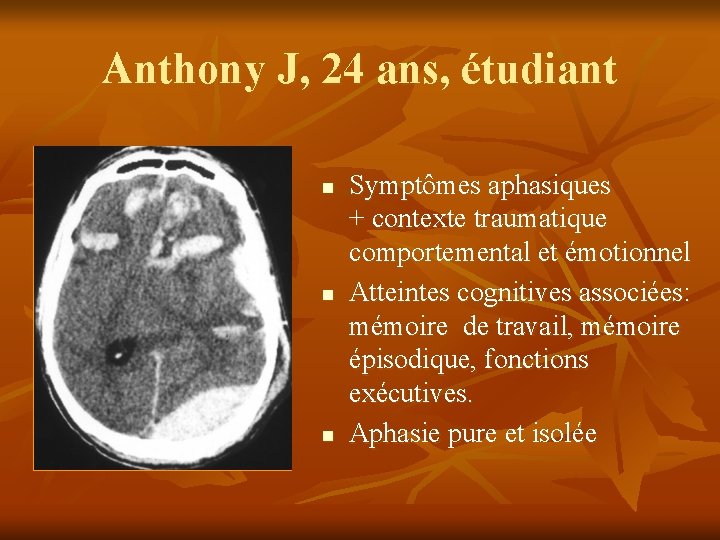 Anthony J, 24 ans, étudiant n n n Symptômes aphasiques + contexte traumatique comportemental Anthony J, 24 ans, étudiant n n n Symptômes aphasiques + contexte traumatique comportemental