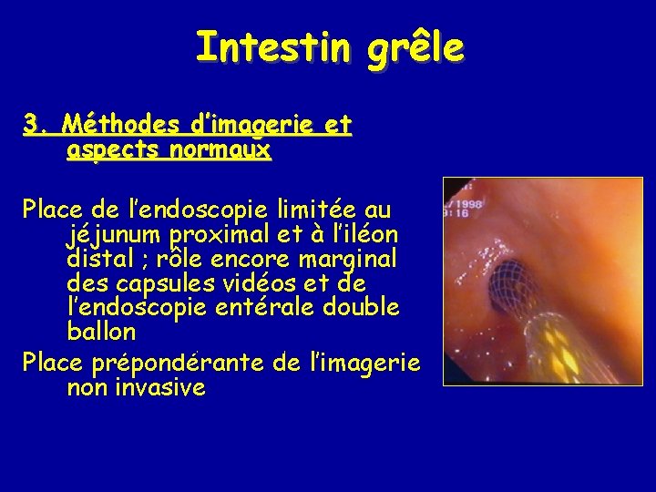 Intestin grêle 3. Méthodes d’imagerie et aspects normaux Place de l’endoscopie limitée au jéjunum