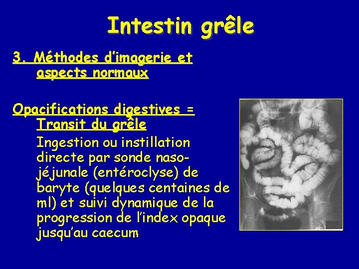 Intestin grêle 3. Méthodes d’imagerie et aspects normaux Opacifications digestives = Transit du grêle