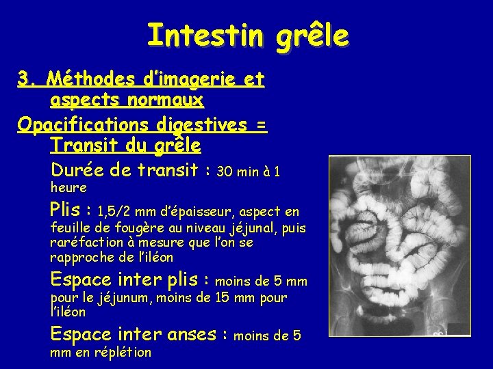 Intestin grêle 3. Méthodes d’imagerie et aspects normaux Opacifications digestives = Transit du grêle