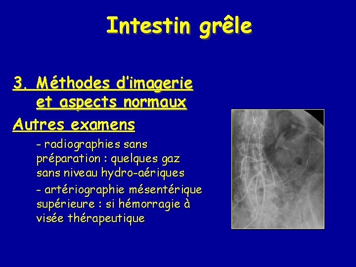 Intestin grêle 3. Méthodes d’imagerie et aspects normaux Autres examens - radiographies sans préparation