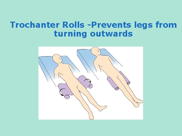 Trochanter Rolls -Prevents legs from turning outwards 