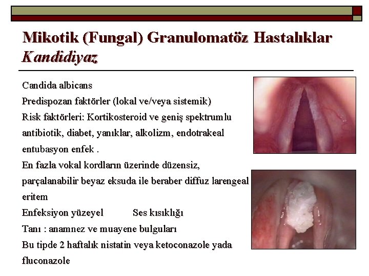 Mikotik (Fungal) Granulomatöz Hastalıklar Kandidiyaz Candida albicans Predispozan faktörler (lokal ve/veya sistemik) Risk faktörleri: