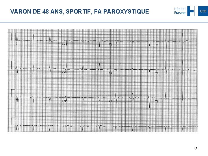 VARON DE 48 ANS, SPORTIF, FA PAROXYSTIQUE 13 