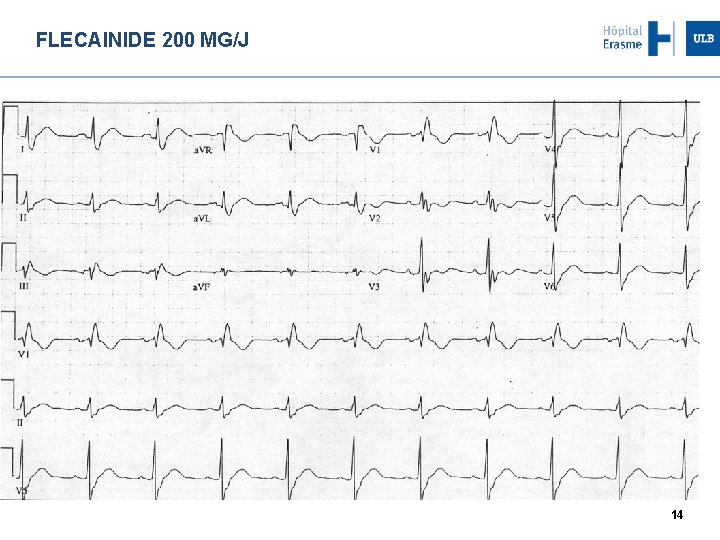 FLECAINIDE 200 MG/J 14 