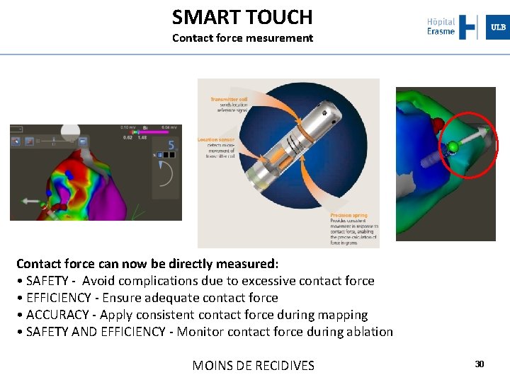 SMART TOUCH Contact force mesurement Contact force can now be directly measured: • SAFETY