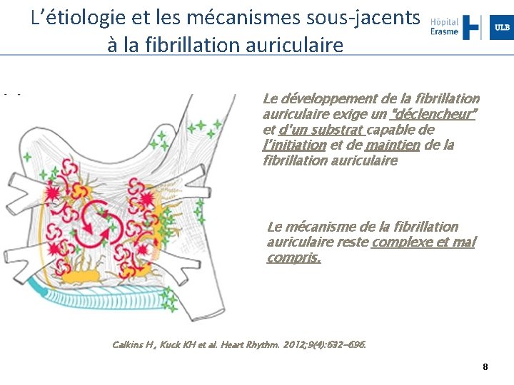 L’étiologie et les mécanismes sous-jacents à la fibrillation auriculaire Le développement de la fibrillation