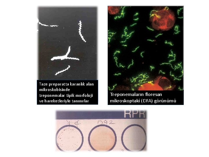 Taze preparatta karanlık alan mikroskobisinde treponemalar tipik morfoloji ve hareketleriyle tanınırlar Treponemaların floresan mikroskoptaki