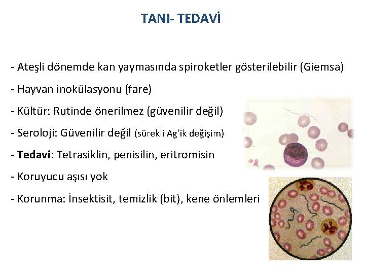 TANI- TEDAVİ - Ateşli dönemde kan yaymasında spiroketler gösterilebilir (Giemsa) - Hayvan inokülasyonu (fare)