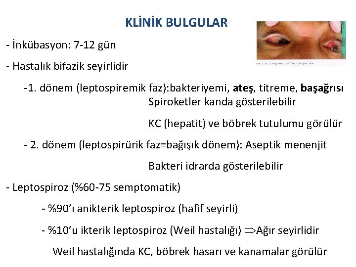 KLİNİK BULGULAR - İnkübasyon: 7 -12 gün - Hastalık bifazik seyirlidir -1. dönem (leptospiremik