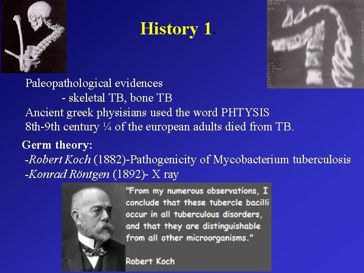 History 1. Paleopathological evidences - skeletal TB, bone TB Ancient greek physisians used the