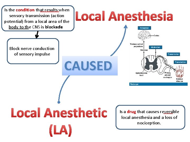 Is the condition that results when sensory transmission (action potential) from a local area