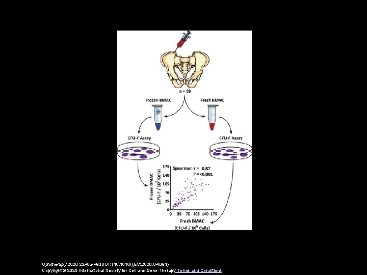 Cytotherapy 2020 22486 -493 DOI: (10. 1016/j. jcyt. 2020. 04. 091) Copyright © 2020