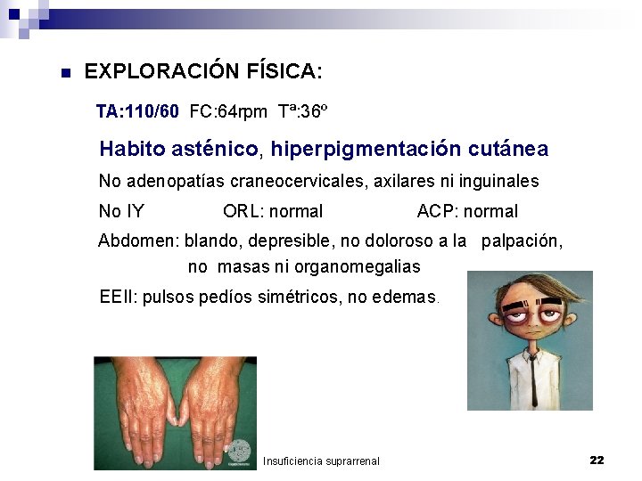 n EXPLORACIÓN FÍSICA: TA: 110/60 FC: 64 rpm Tª: 36º Habito asténico, hiperpigmentación cutánea