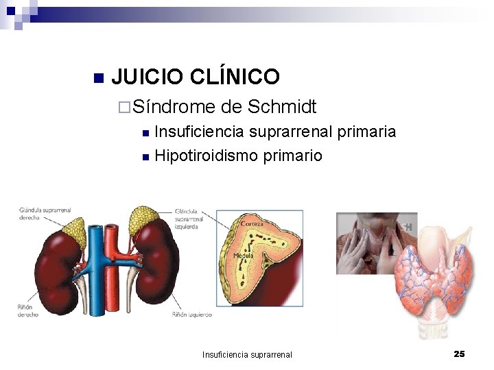 n JUICIO CLÍNICO ¨ Síndrome de Schmidt Insuficiencia suprarrenal primaria n Hipotiroidismo primario n