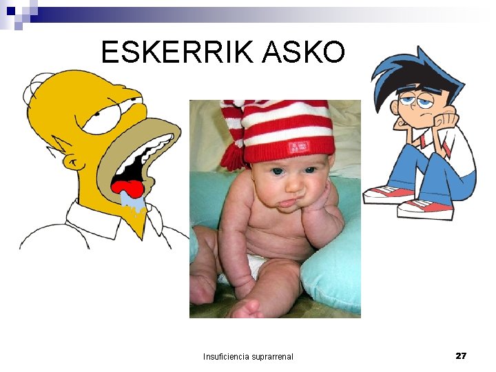 ESKERRIK ASKO Insuficiencia suprarrenal 27 