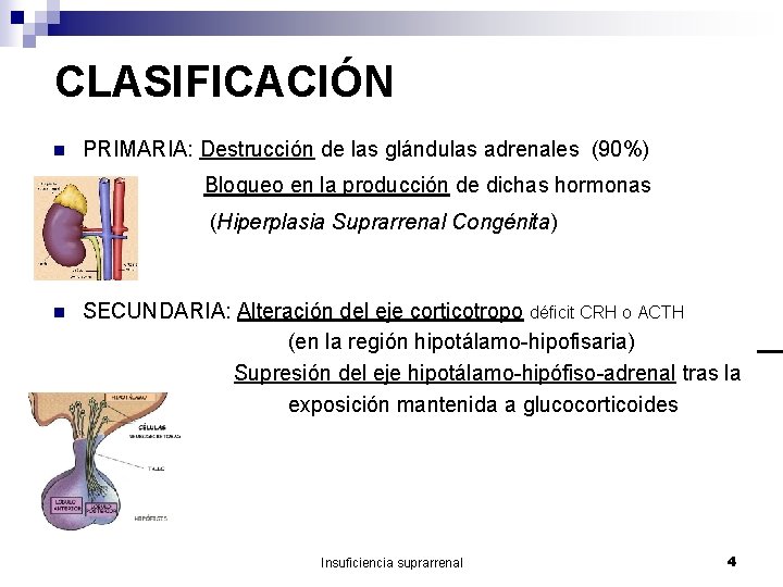 CLASIFICACIÓN n PRIMARIA: Destrucción de las glándulas adrenales (90%) Bloqueo en la producción de