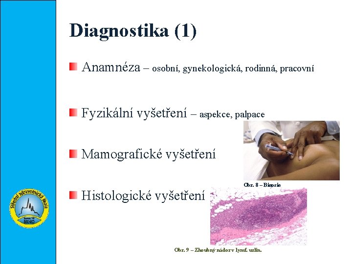 Diagnostika (1) Anamnéza – osobní, gynekologická, rodinná, pracovní Fyzikální vyšetření – aspekce, palpace Mamografické