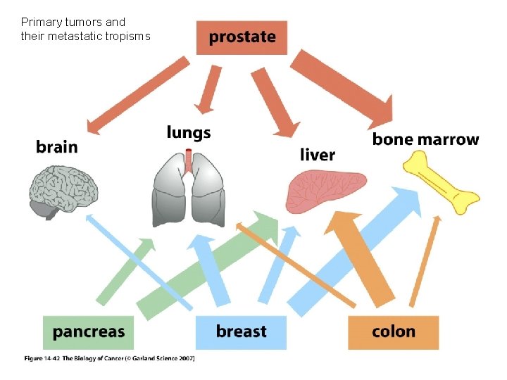 Primary tumors and their metastatic tropisms 