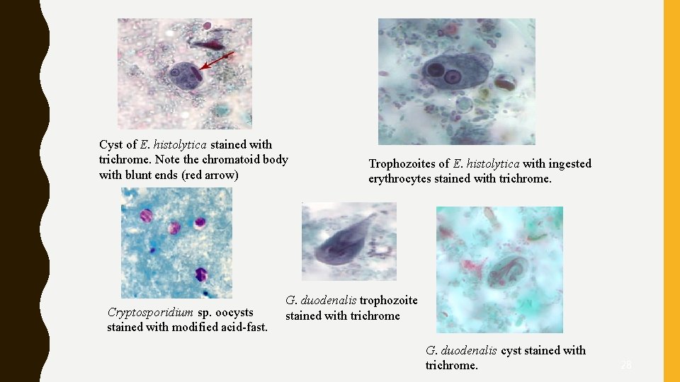 Cyst of E. histolytica stained with trichrome. Note the chromatoid body with blunt ends