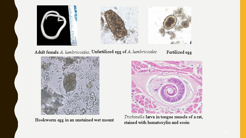 Adult female A. lumbricoides. Unfertilized egg of A. lumbricoides Hookworm egg in an unstained