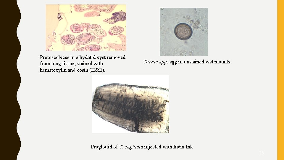 Protoscoleces in a hydatid cyst removed from lung tissue, stained with hematoxylin and eosin