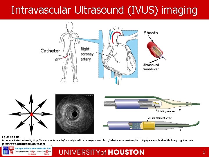 Intravascular Ultrasound (IVUS) imaging Figure credits: Montana State University http: //www. montana. edu/wwwai/imsd/diabetes/myocard. htm,