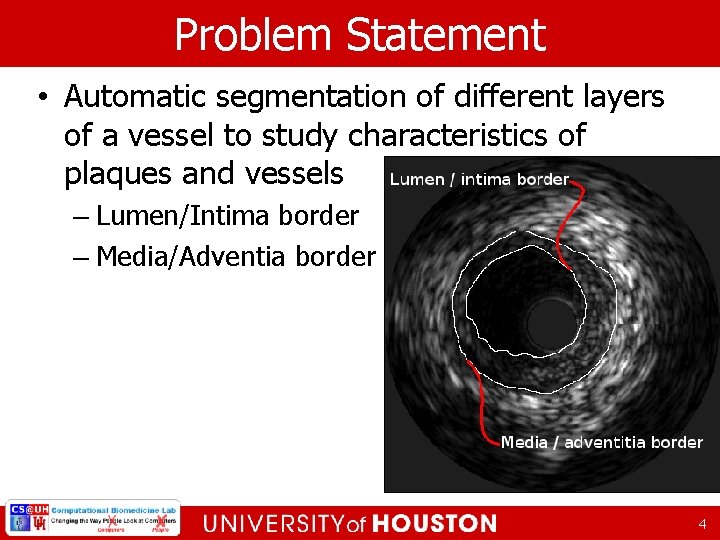 Problem Statement • Automatic segmentation of different layers of a vessel to study characteristics