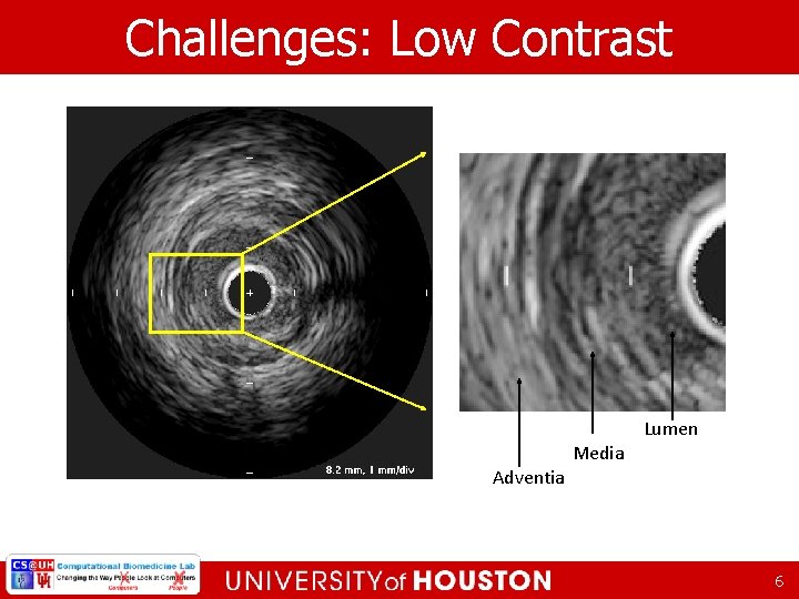 Challenges: Low Contrast Adventia Media Lumen 6 