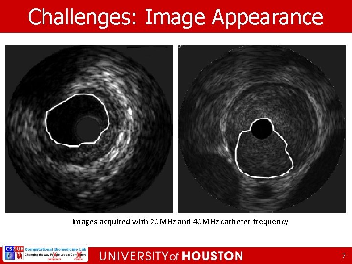 Challenges: Image Appearance Images acquired with 20 MHz and 40 MHz catheter frequency 7