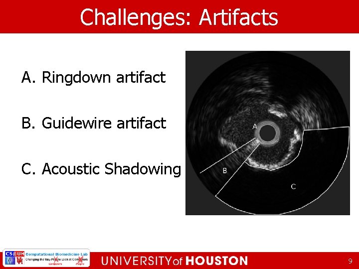 Challenges: Artifacts A. Ringdown artifact B. Guidewire artifact C. Acoustic Shadowing 9 