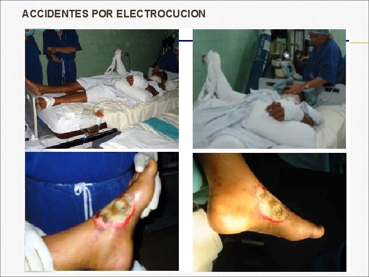 ACCIDENTES POR ELECTROCUCION 