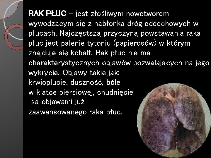 RAK PŁUC - jest złośliwym nowotworem wywodzącym się z nabłonka dróg oddechowych w płucach.