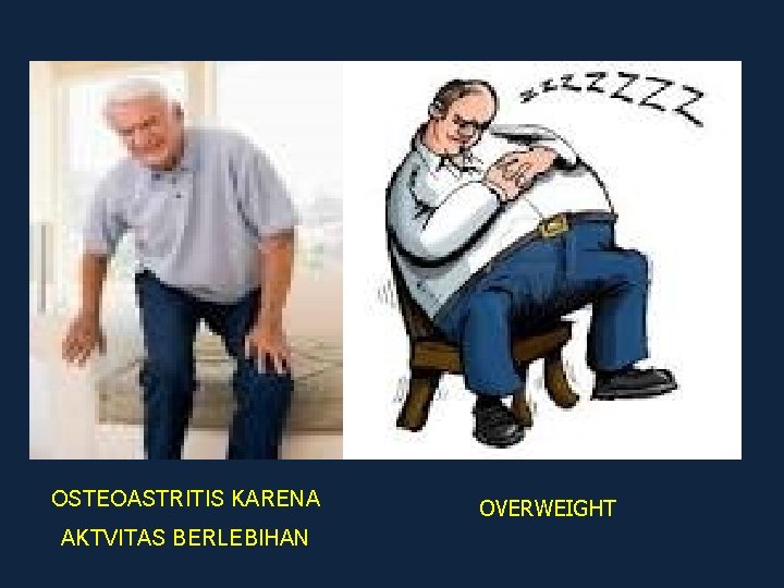 OSTEOASTRITIS KARENA AKTVITAS BERLEBIHAN OVERWEIGHT 