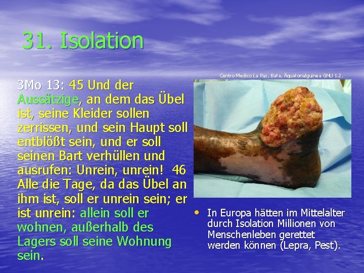 31. Isolation 3 Mo 13: 45 Und der Aussätzige, an dem das Übel ist,