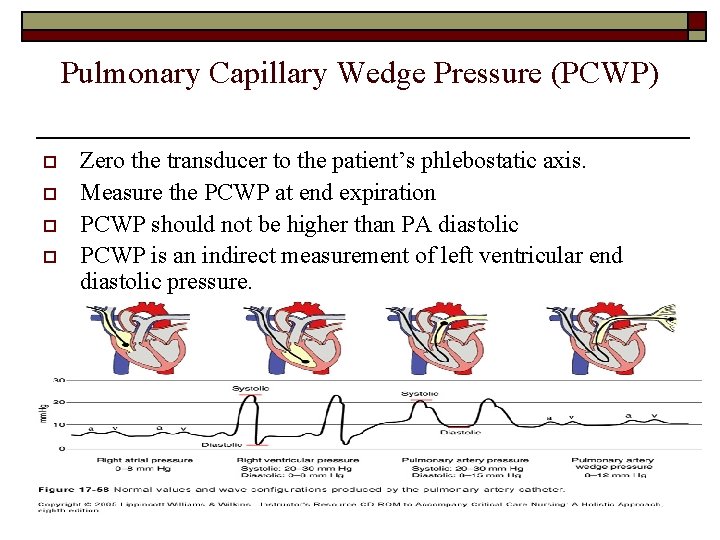 Pulmonary Capillary Wedge Pressure (PCWP) o o Zero the transducer to the patient’s phlebostatic