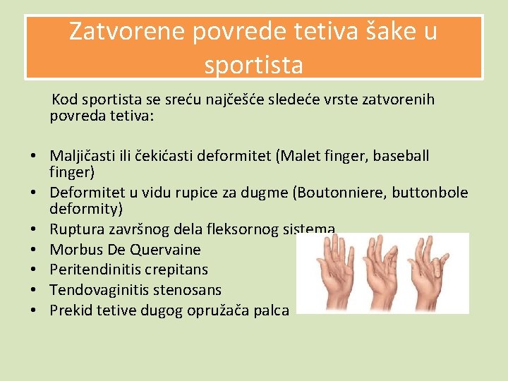 Zatvorene povrede tetiva šake u sportista Kod sportista se sreću najčešće sledeće vrste zatvorenih