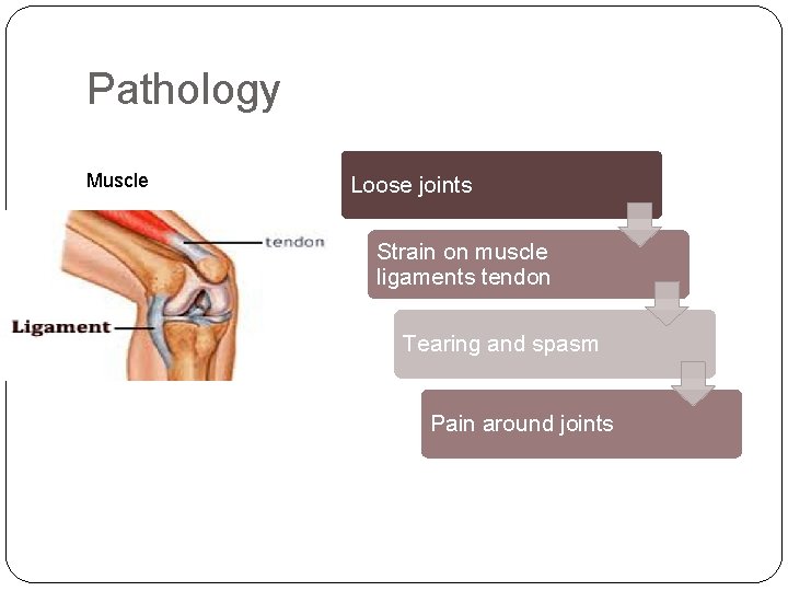 Pathology Muscle Loose joints Strain on muscle ligaments tendon Tearing and spasm Pain around