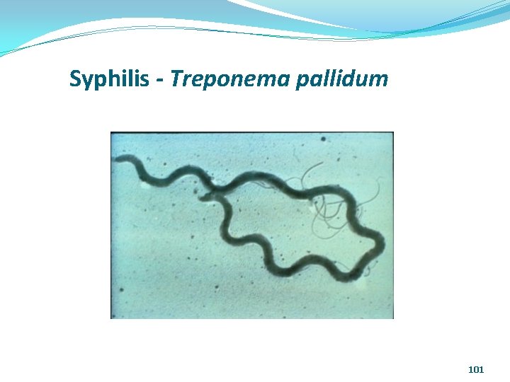 Syphilis - Treponema pallidum 101 