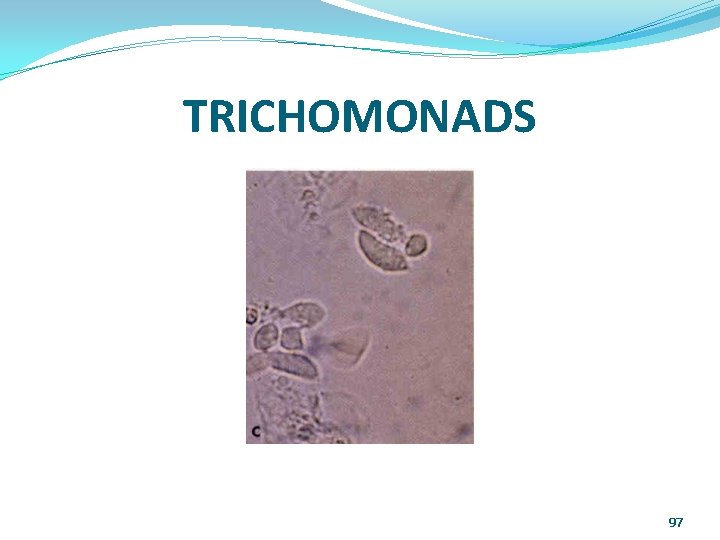 TRICHOMONADS 97 
