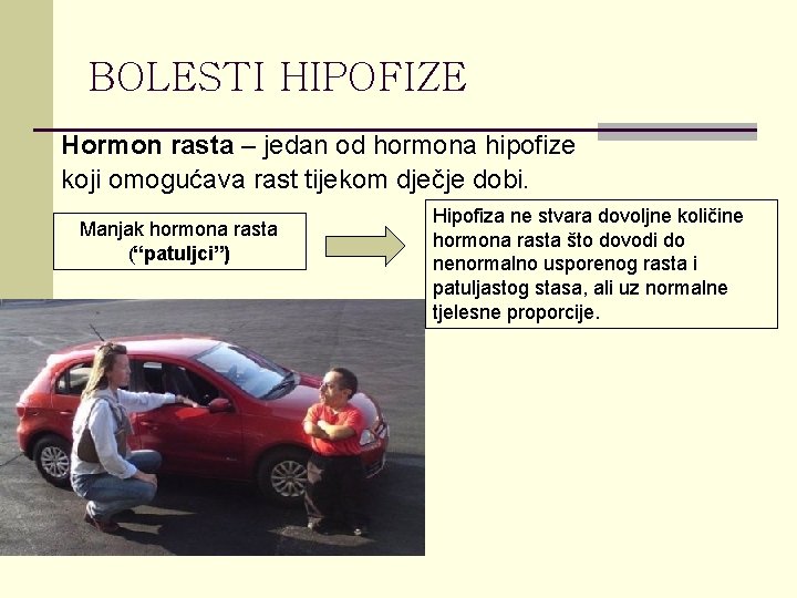 BOLESTI HIPOFIZE Hormon rasta – jedan od hormona hipofize koji omogućava rast tijekom dječje