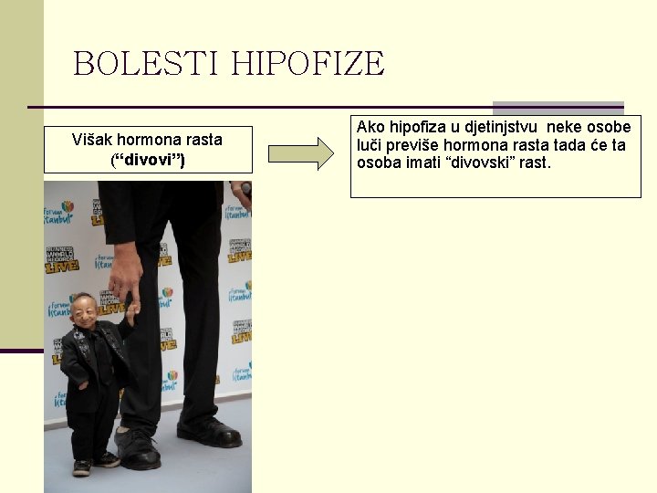 BOLESTI HIPOFIZE Višak hormona rasta (“divovi”) Ako hipofiza u djetinjstvu neke osobe luči previše