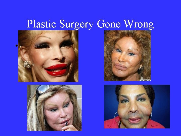 Plastic Surgery Gone Wrong • 