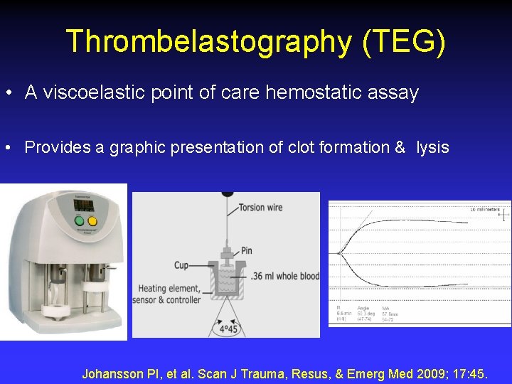 Thrombelastography (TEG) • A viscoelastic point of care hemostatic assay • Provides a graphic