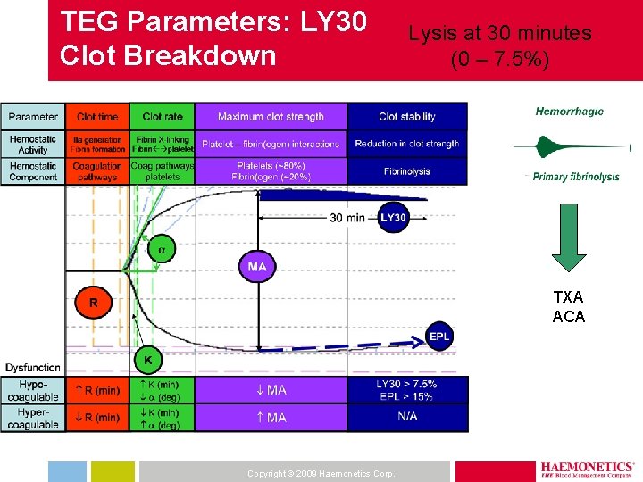 TEG Parameters: LY 30 Clot Breakdown Lysis at 30 minutes (0 – 7. 5%)